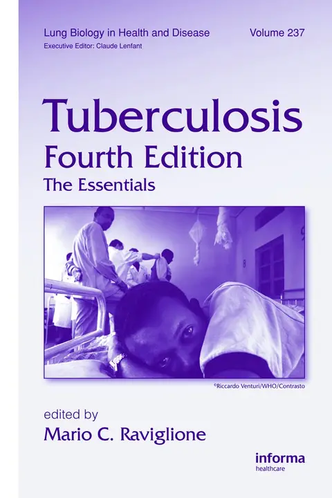 Cover of Tuberculosis