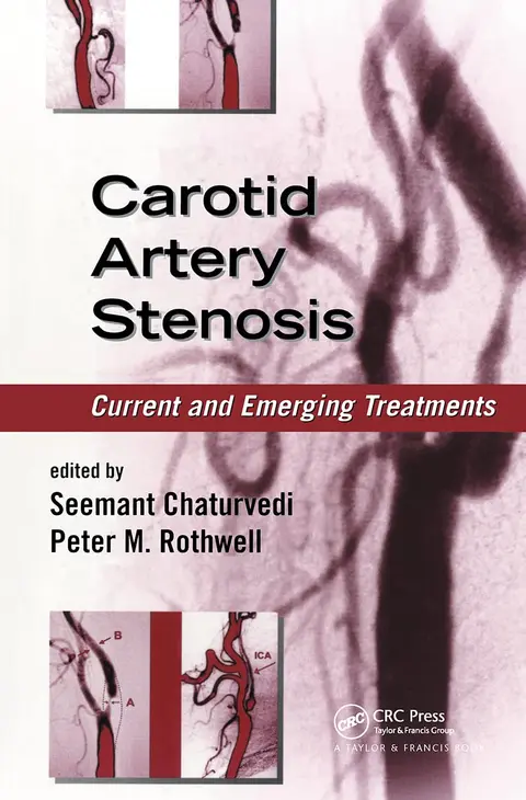 Cover of Carotid Artery Stenosis