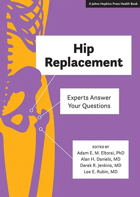 Cover of Hip Replacement