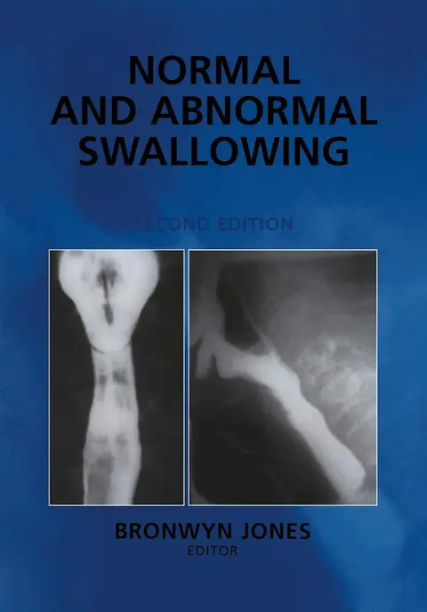 Cover of Normal and Abnormal Swallowing