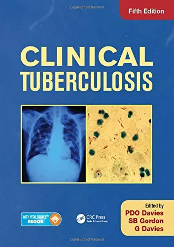 Cover of Clinical Tuberculosis