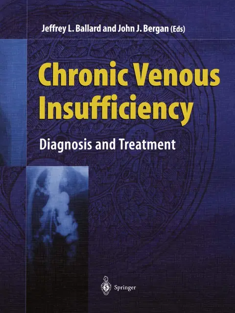Cover of Chronic Venous Insufficiency