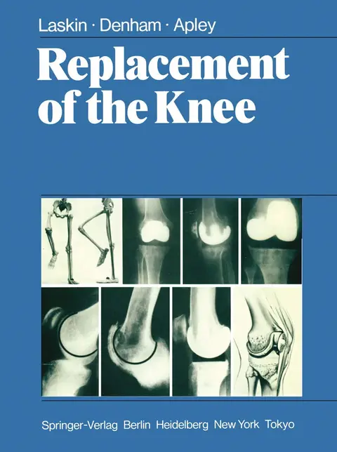Cover of Replacement of the Knee