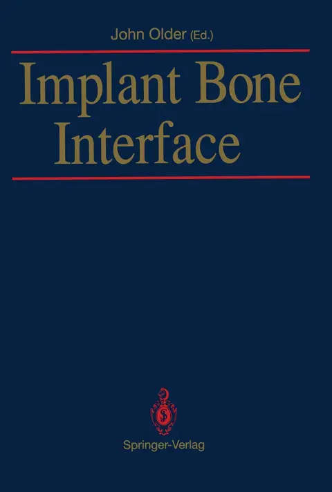 Cover of Implant Bone Interface