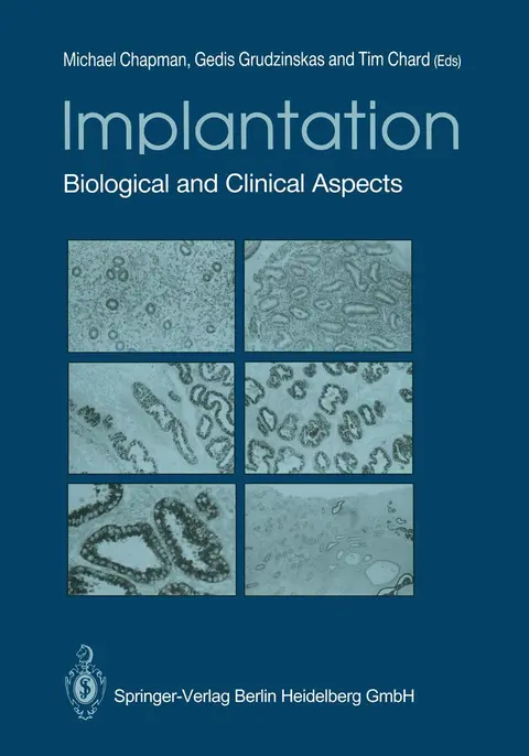 Cover of Implantation