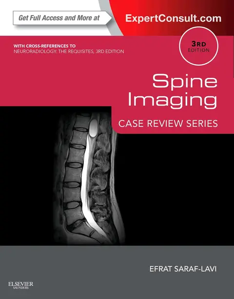 Cover of Spine Imaging