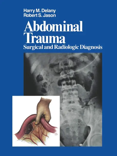 Cover of Abdominal Trauma