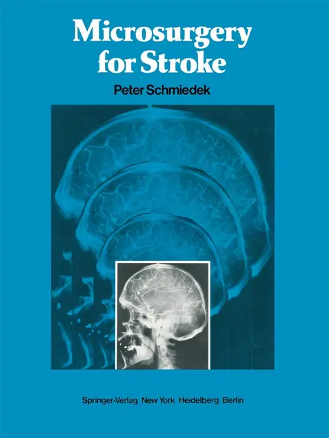 Cover of Microsurgery for Stroke