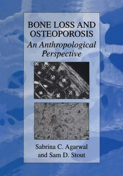 Cover of Bone Loss and Osteoporosis