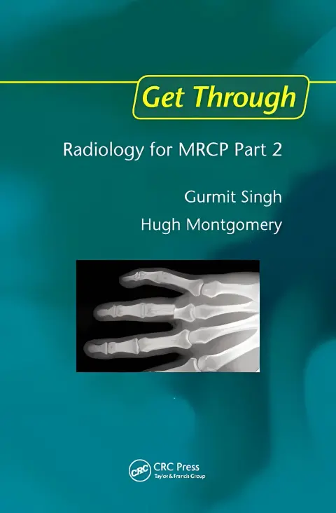 Cover of Get Through Radiology for MRCP Part 2