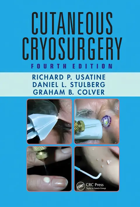 Cover of Cutaneous Cryosurgery