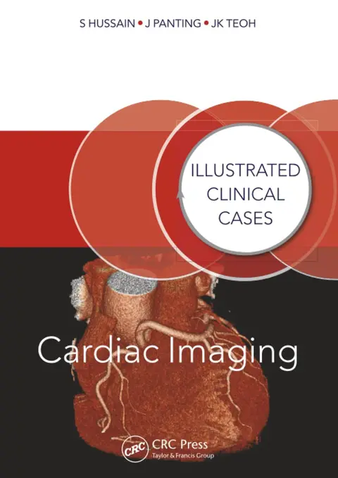 Cover of Cardiac Imaging