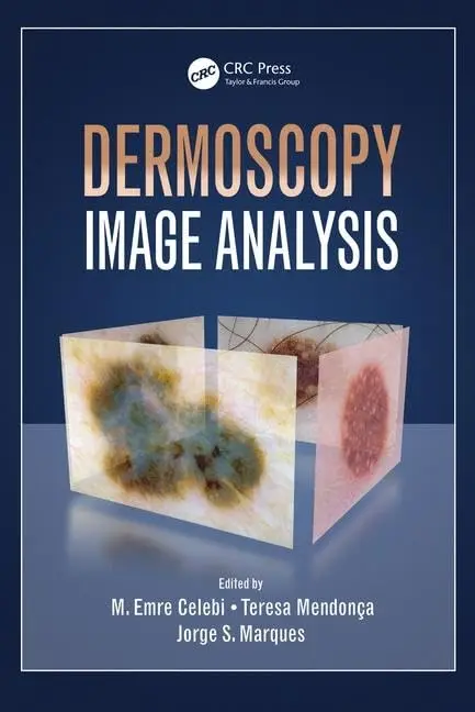 Cover of Dermoscopy Image Analysis