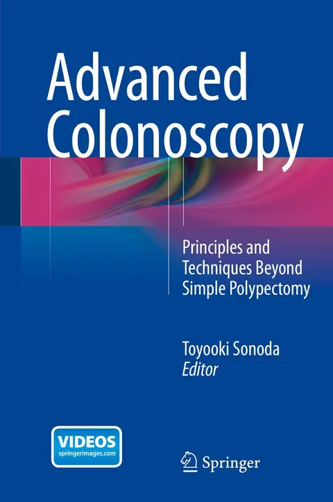 Cover of Advanced Colonoscopy