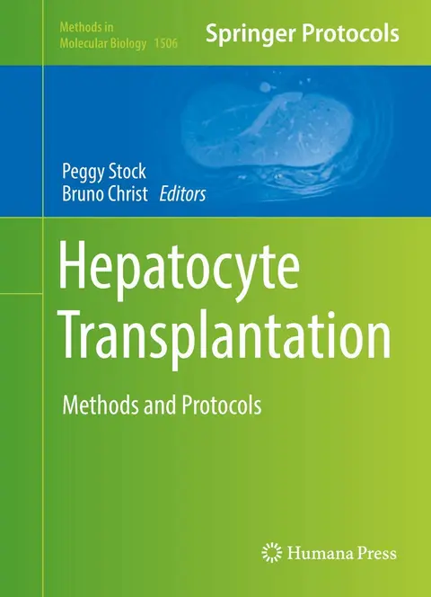 Cover of Hepatocyte Transplantation