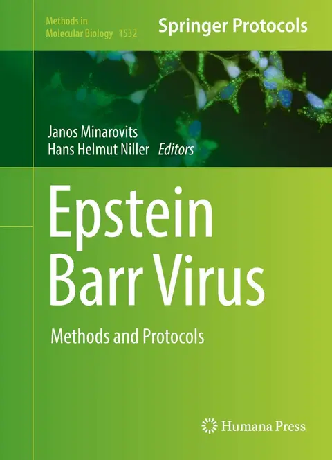 Cover of Epstein Barr Virus