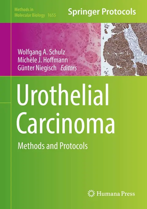 Cover of Urothelial Carcinoma