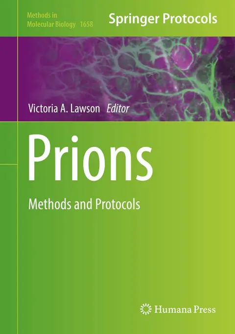 Cover of Prions