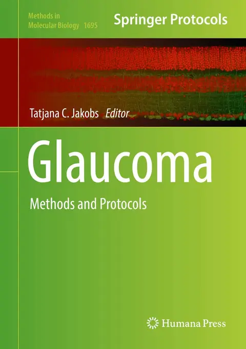 Cover of Glaucoma Methods and Protocols