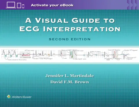 Cover of Visual Guide to ECG Interpretation