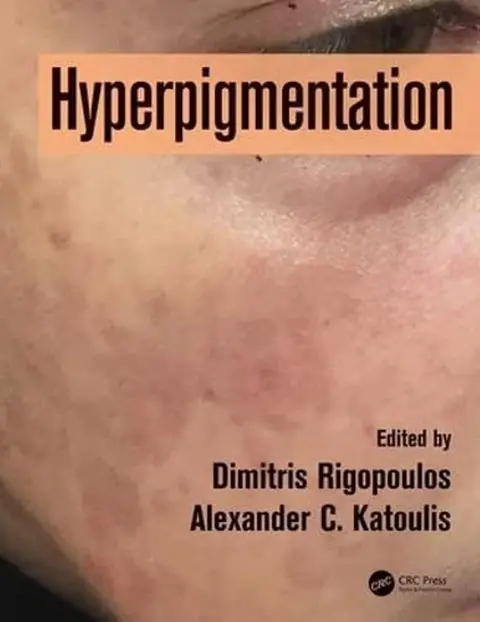 Cover of Hyperpigmentation