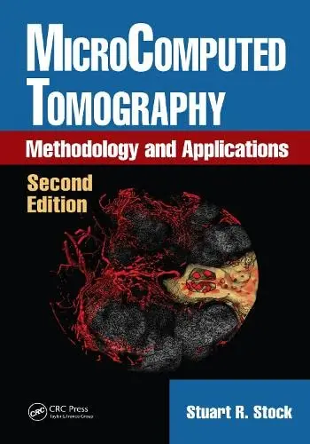 Cover of MicroComputed Tomography