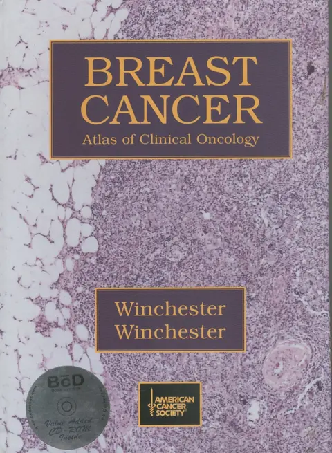 Cover of Breast Cancer