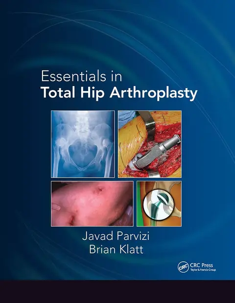 Cover of Essentials in Total Hip Arthroplasty