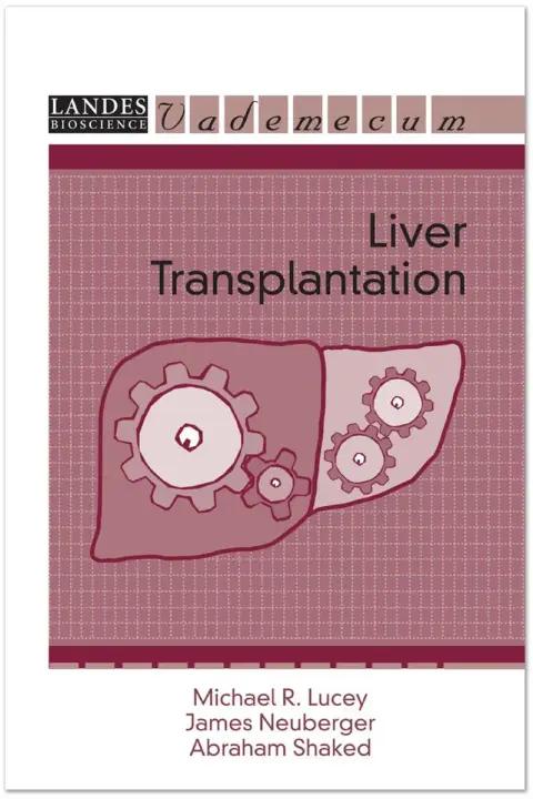 Cover of Liver Transplantation