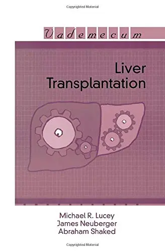 Cover of Liver Transplantation