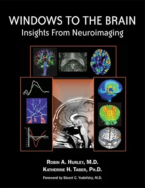 Cover of Windows to the Brain