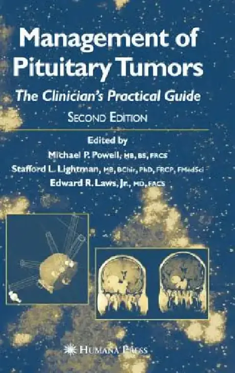 Cover of Management of Pituitary Tumors