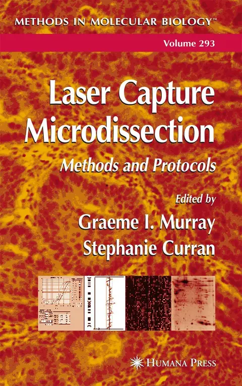 Cover of Laser Capture Microdissection