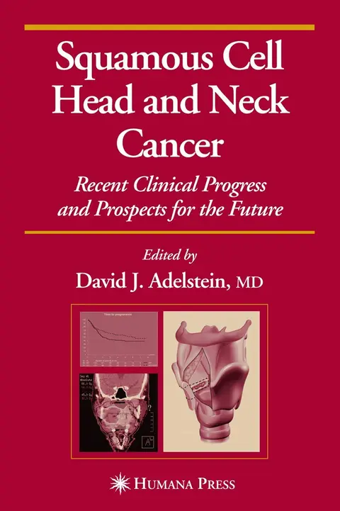 Cover of Squamous Cell Head and Neck Cancer