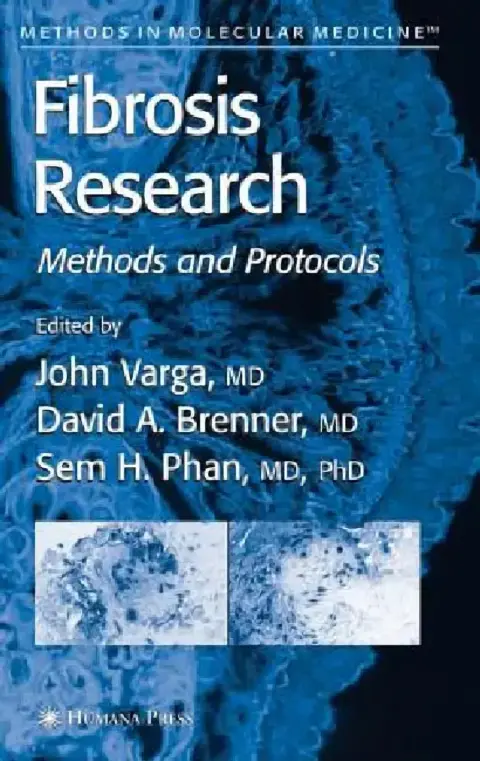 Cover of Fibrosis Research