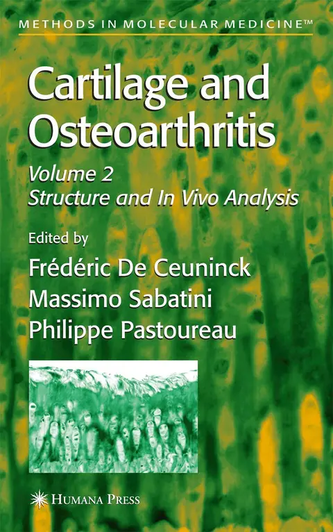 Cover of Cartilage and Osteoarthritis