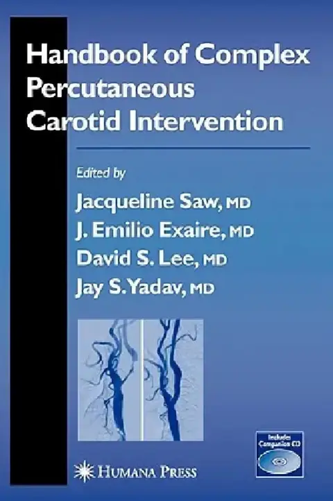 Cover of Handbook of Complex Percutaneous Carotid Intervention