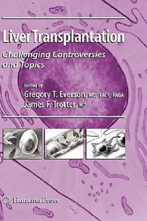 Cover of Liver Transplantation