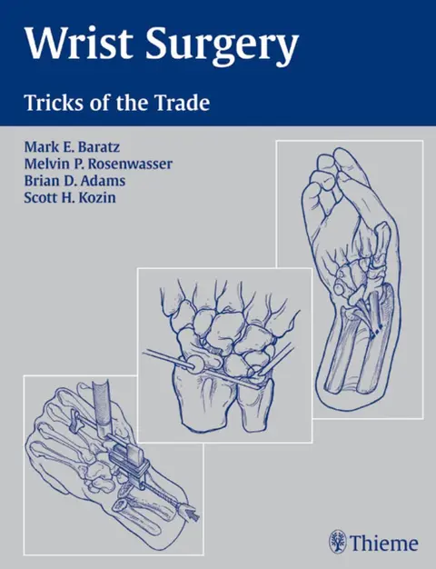 Cover of Wrist Surgery