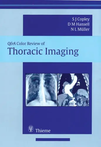 Cover of Thoracic Imaging