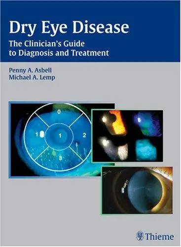 Cover of Dry Eye Disease