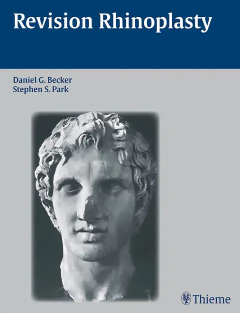 Cover of Revision rhinoplasty