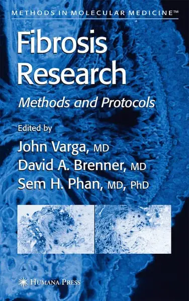 Cover of Fibrosis Research. Methods and Protocols