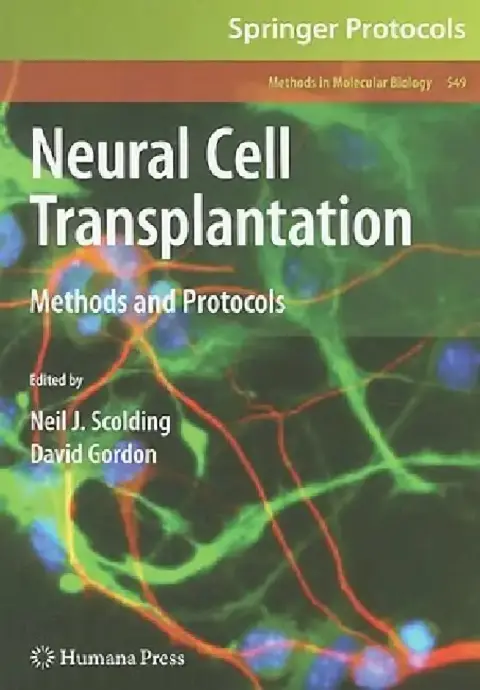 Cover of Neural Cell Transplantation