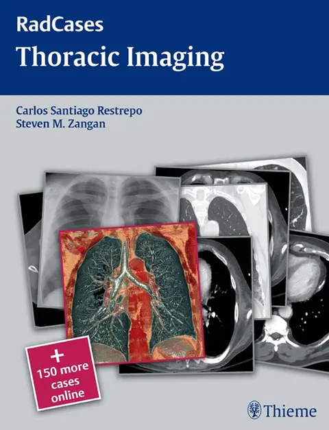 Cover of Thoracic Imaging