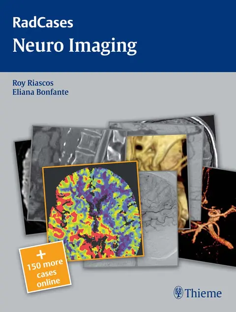 Cover of Neuro Imaging