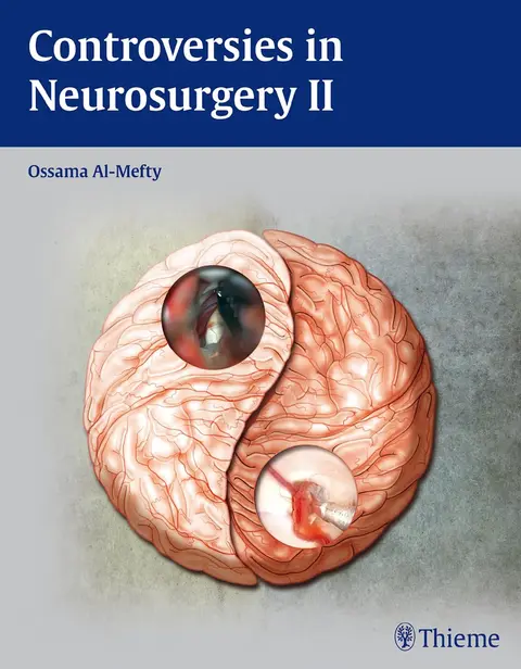Cover of Controversies in Neurosurgery 2