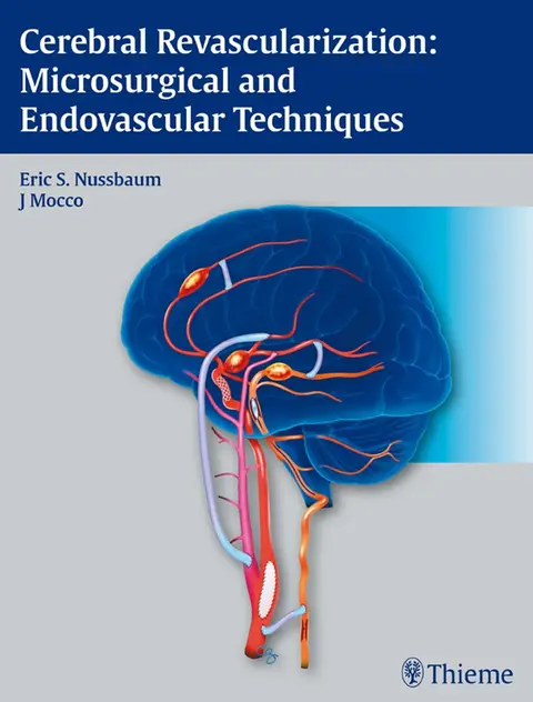Cover of Cerebral Revascularization Microsurgical and Endov