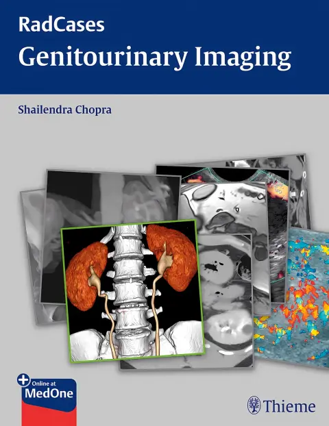 Cover of Genitourinary imaging