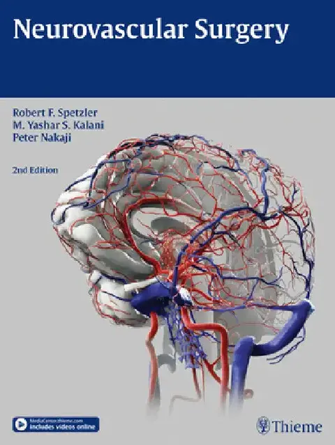 Cover of Neurovascular Surgery